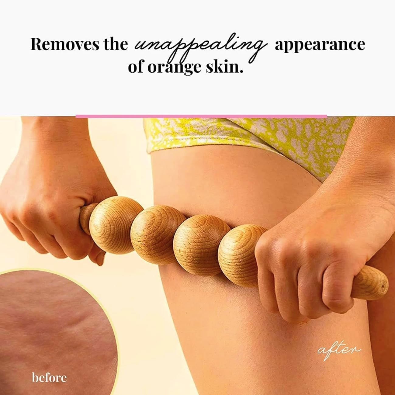 Accessories anti Cellulite Ball Massage Device Massager Roller with Handle Maderotherapy Wooden